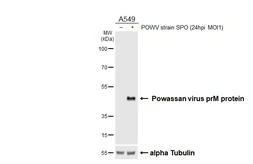 Anti-Powassan virus prM protein antibody [HL4038] used in Western Blot (WB). GTX642369