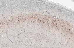 Anti-GPR54 antibody [HL4049] used in IHC (Paraffin sections) (IHC-P). GTX642464