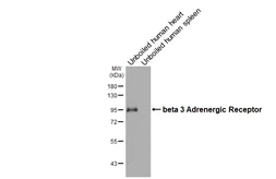 Anti-beta 3 Adrenergic Receptor antibody [HL4051] used in Western Blot (WB). GTX642466