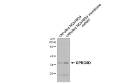 Anti-GPRC5D antibody [HL4056] used in Western Blot (WB). GTX642471