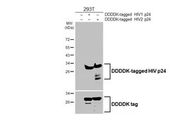 Anti-HIV p24 antibody [HL4058] used in Western Blot (WB). GTX642473