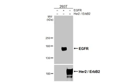 Anti-EGFR antibody [HL1097] used in Western Blot (WB). GTX642543