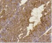 Anti-BDNF antibody [GT1094] used in IHC (Paraffin sections) (IHC-P). GTX64286