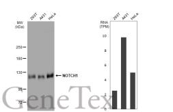 Anti-NOTCH1 antibody [GT1099] used in Western Blot (WB). GTX64291