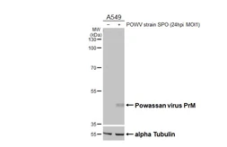 Anti-Powassan virus prM protein antibody [HL4163] used in Western Blot (WB). GTX642968