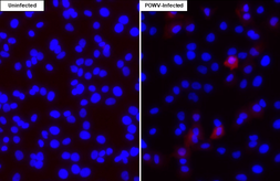 Anti-Powassan virus NS5 antibody [HL4165] used in Immunocytochemistry/ Immunofluorescence (ICC/IF). GTX642970