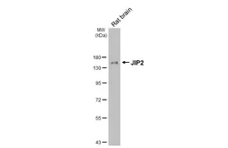 Anti-JIP2 antibody [GT170] used in Western Blot (WB). GTX642976