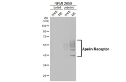Anti-Apelin Receptor antibody [HL4171] used in Western Blot (WB). GTX642985