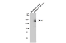 Anti-BAI1 antibody [HL4184] used in Western Blot (WB). GTX642998