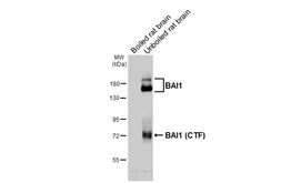 Anti-BAI1 antibody [HL4190] used in Western Blot (WB). GTX643004