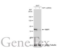 Anti-YAP1 antibody [GT1112] used in Western Blot (WB). GTX64304
