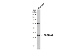 Anti-SLC25A1 antibody [HL4227] used in Western Blot (WB). GTX643060