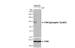 Anti-FAK (phospho Tyr407) antibody [HL4231] used in Western Blot (WB). GTX643064