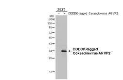 Anti-Coxsackievirus A6 VP2 antibody [HL4233] used in Western Blot (WB). GTX643066