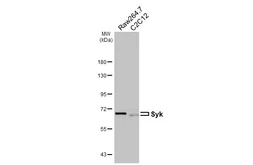 Anti-Syk antibody [HL4248] used in Western Blot (WB). GTX643081