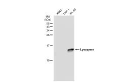 Anti-Lysozyme antibody [GT1123] used in Western Blot (WB). GTX64315