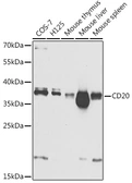 Anti-CD20 antibody used in Western Blot (WB). GTX64329