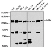 Anti-CD26 antibody used in Western Blot (WB). GTX64333