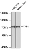 Anti-YAP1 antibody used in Western Blot (WB). GTX64339