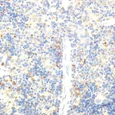 Anti-FOXP3 antibody used in IHC (Paraffin sections) (IHC-P). GTX64343