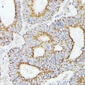 Anti-STAT1 antibody used in IHC (Paraffin sections) (IHC-P). GTX64344