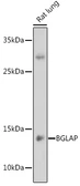 Anti-Osteocalcin antibody used in Western Blot (WB). GTX64348