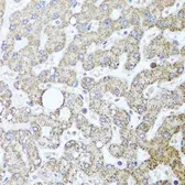 Anti-TSG101 antibody used in IHC (Paraffin sections) (IHC-P). GTX64349