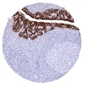 Anti-pan Cytokeratin antibody [HMV4276] HistoMAX&trade; used in IHC (Paraffin sections) (IHC-P). GTX643512