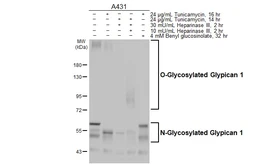Anti-Glypican 1 antibody [HL4279] used in Western Blot (WB). GTX643519