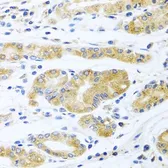 Anti-Apolipoprotein E antibody used in IHC (Paraffin sections) (IHC-P). GTX64352