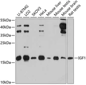 Anti-IGF1 antibody used in Western Blot (WB). GTX64353