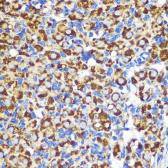 Anti-FGF2 antibody used in IHC (Paraffin sections) (IHC-P). GTX64354