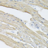 Anti-BMP2 antibody used in IHC (Paraffin sections) (IHC-P). GTX64355