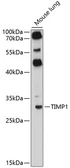 Anti-TIMP1 antibody used in Western Blot (WB). GTX64360
