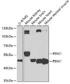 Anti-PINK1 antibody used in Western Blot (WB). GTX64362