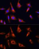 Anti-PINK1 antibody used in Immunocytochemistry/ Immunofluorescence (ICC/IF). GTX64362
