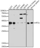 Anti-eIF2 alpha antibody used in Western Blot (WB). GTX64363