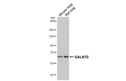 Anti-GALNT2 antibody [HL4377] used in Western Blot (WB). GTX643634