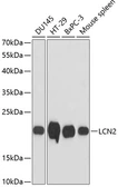 Anti-Lipocalin-2 antibody used in Western Blot (WB). GTX64364