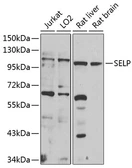 Anti-CD62P antibody used in Western Blot (WB). GTX64365