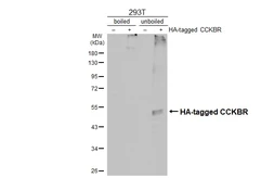 Anti-CCKBR antibody [HL4404] used in Western Blot (WB). GTX643661