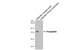 Anti-Frizzled 8 antibody [HL4405] used in Western Blot (WB). GTX643662