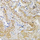 Anti-Wnt3a antibody used in IHC (Paraffin sections) (IHC-P). GTX64367