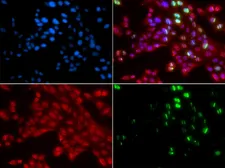 Anti-53BP1 antibody used in Immunocytochemistry/ Immunofluorescence (ICC/IF). GTX64370