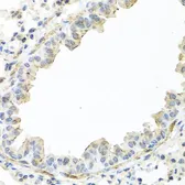 Anti-IL22 antibody used in IHC (Paraffin sections) (IHC-P). GTX64371