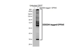 Anti-GPR45 antibody [HL4430] used in Western Blot (WB). GTX643719