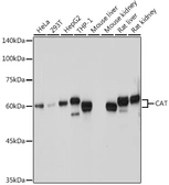 Anti-Catalase antibody used in Western Blot (WB). GTX64374