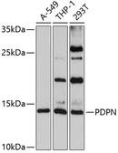 Anti-Podoplanin antibody used in Western Blot (WB). GTX64376