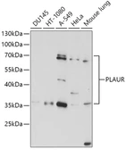 Anti-uPAR antibody used in Western Blot (WB). GTX64381