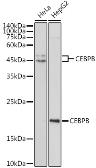 Anti-C/EBP beta antibody used in Western Blot (WB). GTX64382